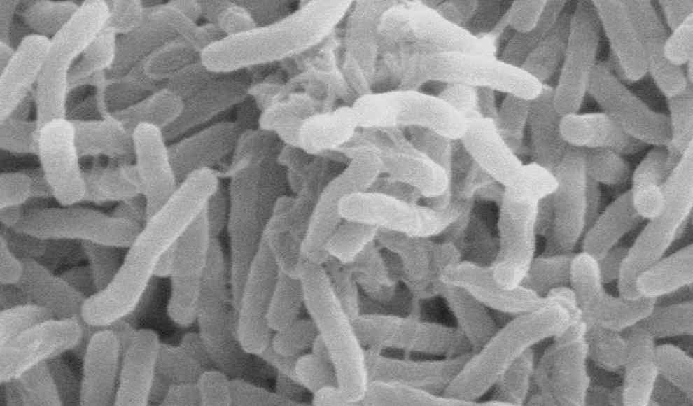 Mediziner bekämpfen Akne-Bakterien erfolgreich mit Viren