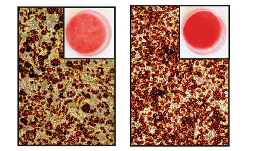 Unterhaut-Fettzellen nach der Bestrahlung mit blauem Licht (links) - Kontroll-Unterhaut-Fettzellen ohne Bestrahlung (rechts)